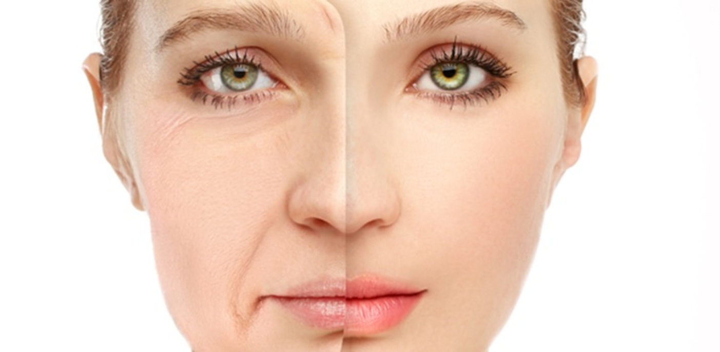 Anti wrinkles